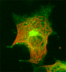 Image 13 COS cell vesicle trafficking and MTs