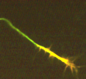 Image 25 growth cone tubulin actin