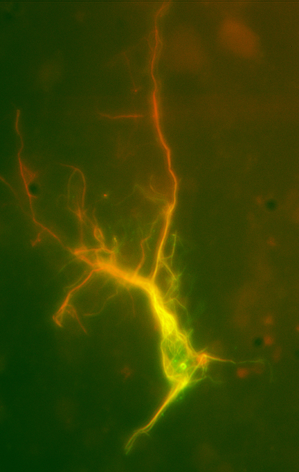 Image 22 fluorescent neuron