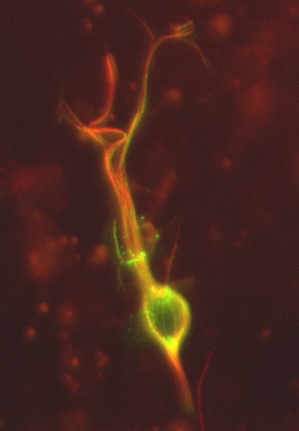 Image 20 dcx dsred and mu1a gfp