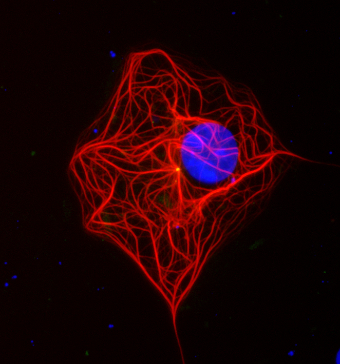 Image 30 cos dcx gamma tubulin