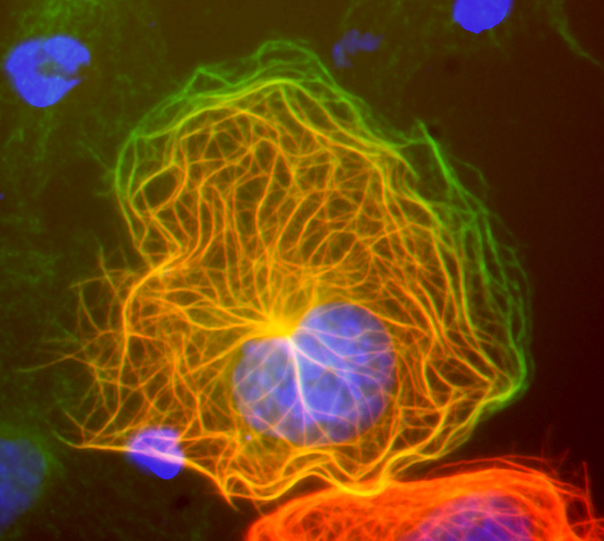 Image 35COS7 cell transfected with DCX DsRed and stained with beta tubulin/FITC.