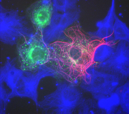 Image 33 cos dcx dsred mpr gfp tubulin blue 2