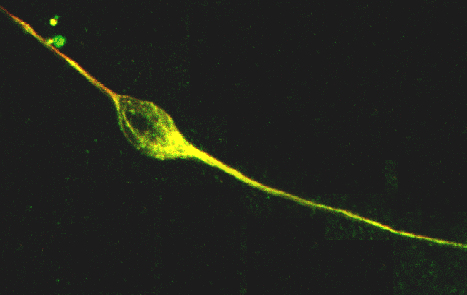 Image 24 confocal neuron2