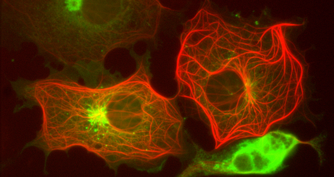 Image 29 cos cells dcx mpr