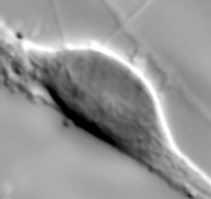 Image 3 neuron migration2